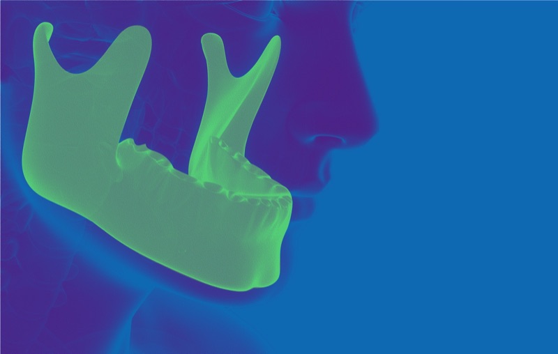 Jaw Structure